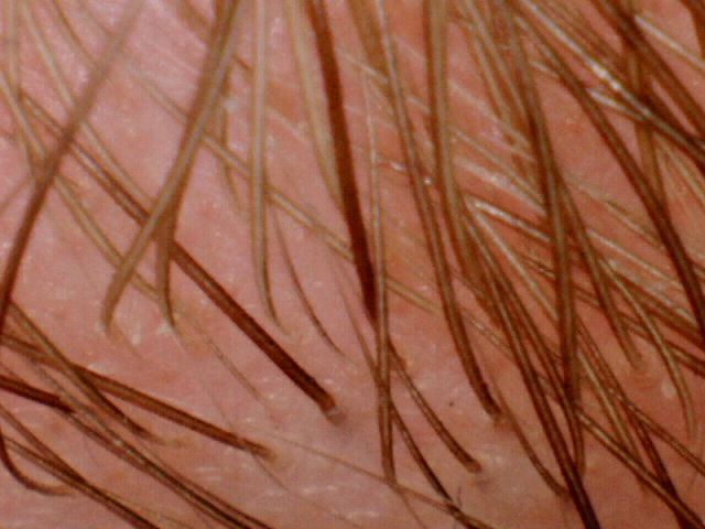eyebrow_hairs